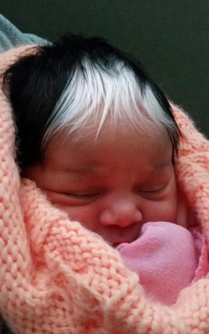 Los Médicos Por Fin Se Dan Cuenta De Por Qué El Bebé Nació Con La Cabeza Llena De Pelo Gris 2460