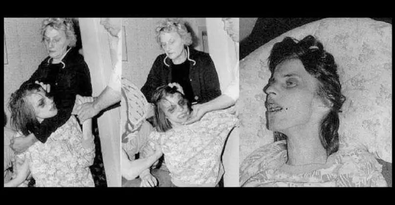 scary-true-photos-of-the-girl-whose-story-inspired-the-exorcism-of