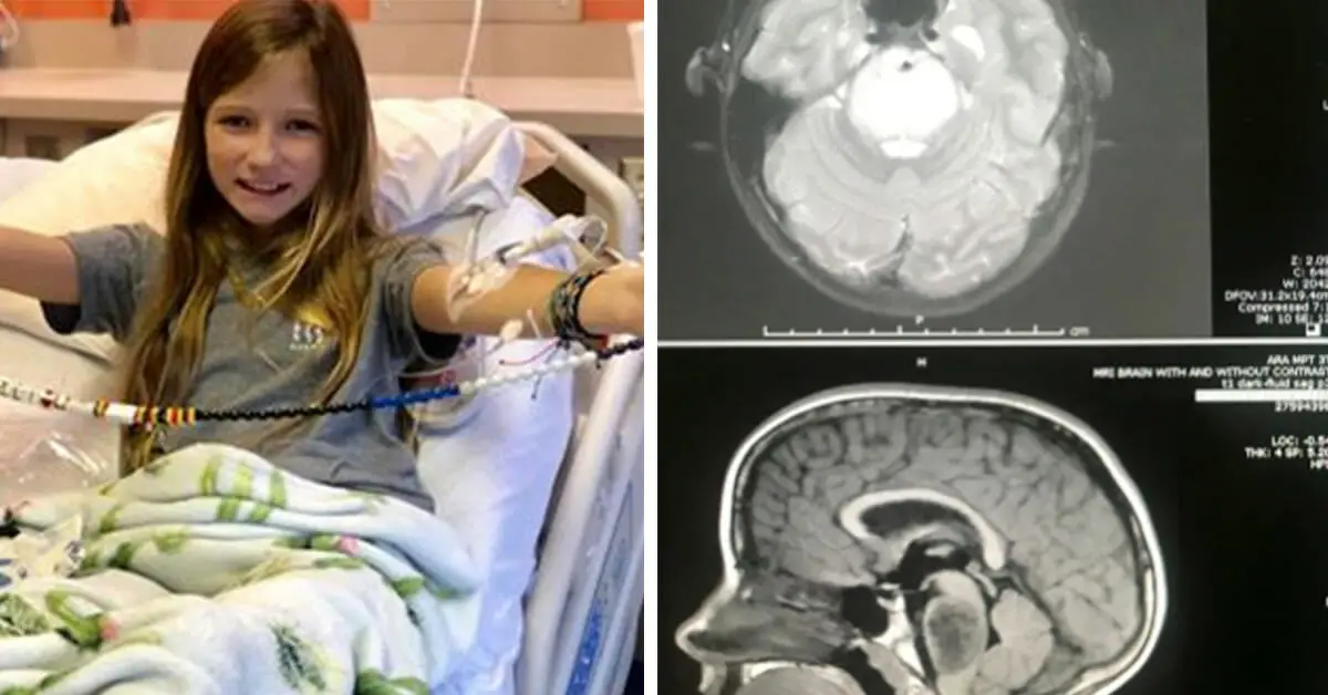 11 Year Old Girls Brain Tumor Miraculously Disappears 0520