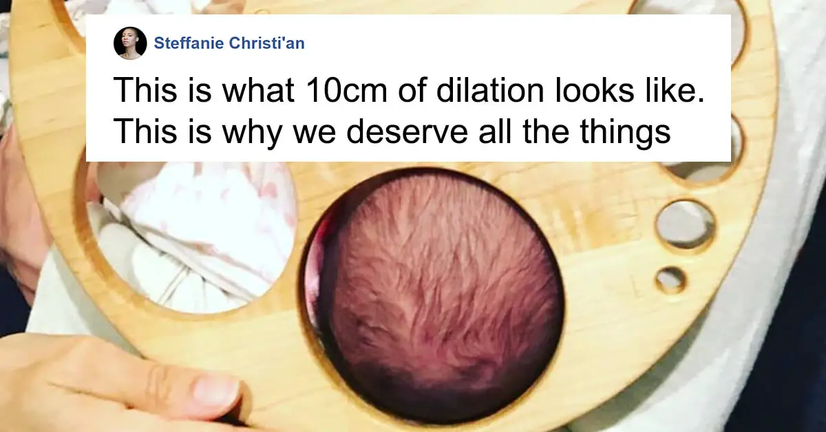 this-dilation-chart-shows-the-remarkable-reality-of-childbirth