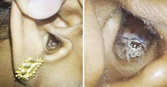 Woman Discovers Her Headaches Are Caused By A Spider Inside Her Ear