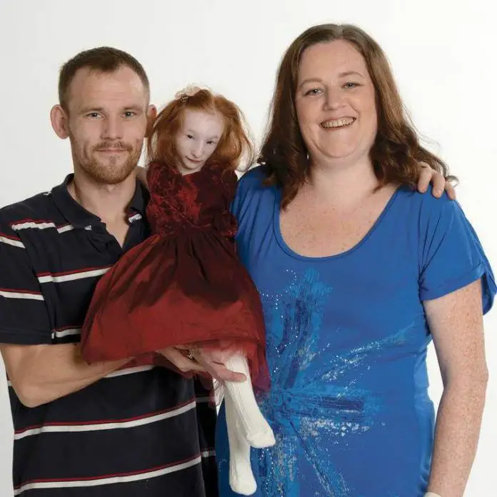 Worlds Tiniest Girl Charlotte Continues To Defy All Medical Odds