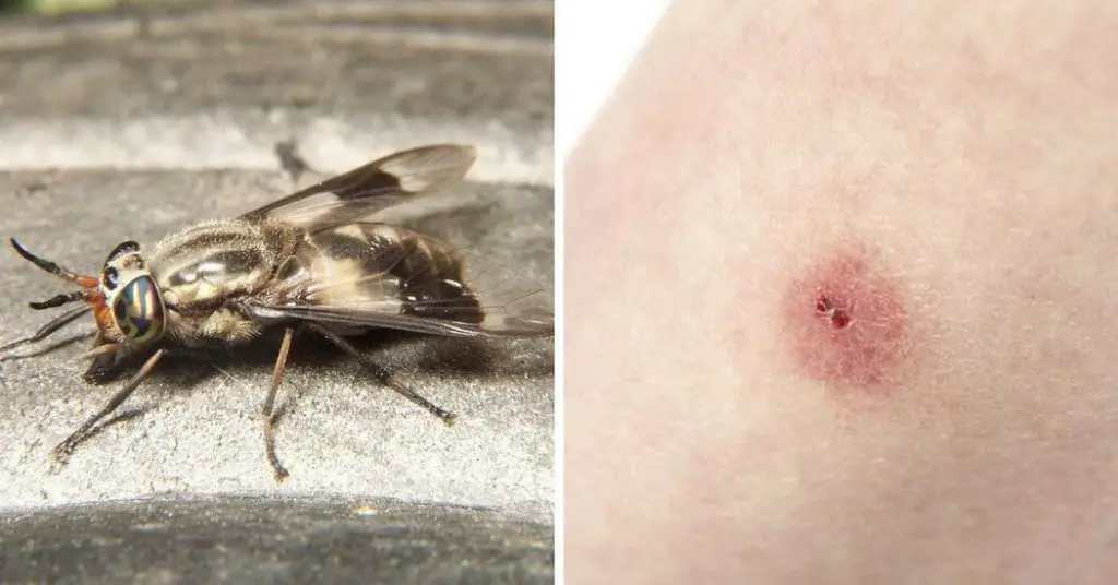 Common Bug Bites And How To Recognize Each One