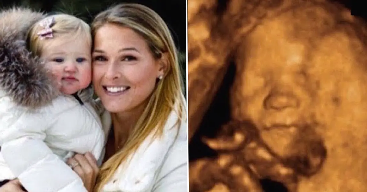 Morgan Miller Says Daughter's Angel Appeared In Son's Ultrasound